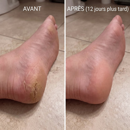 Baume anti-âge réparateur en profondeur pour les talons