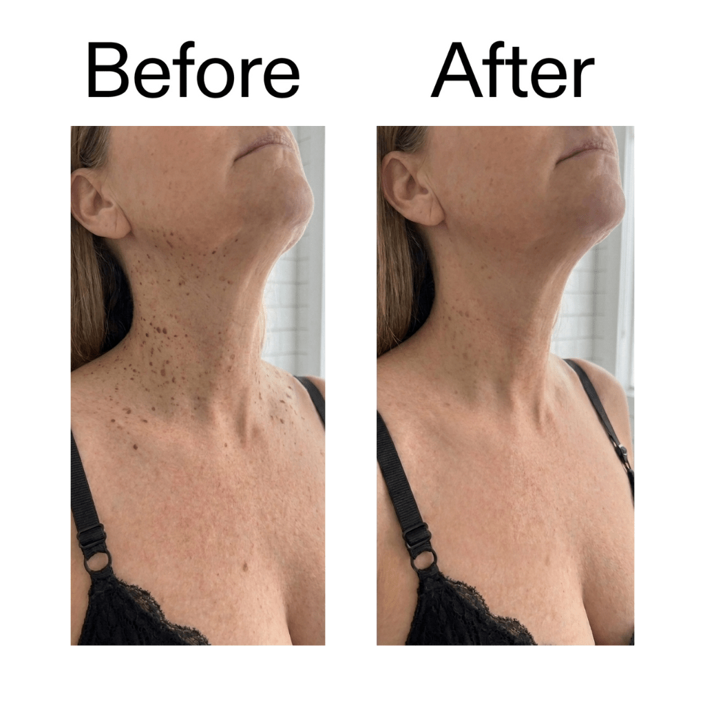 Stick Lissant Glycolique