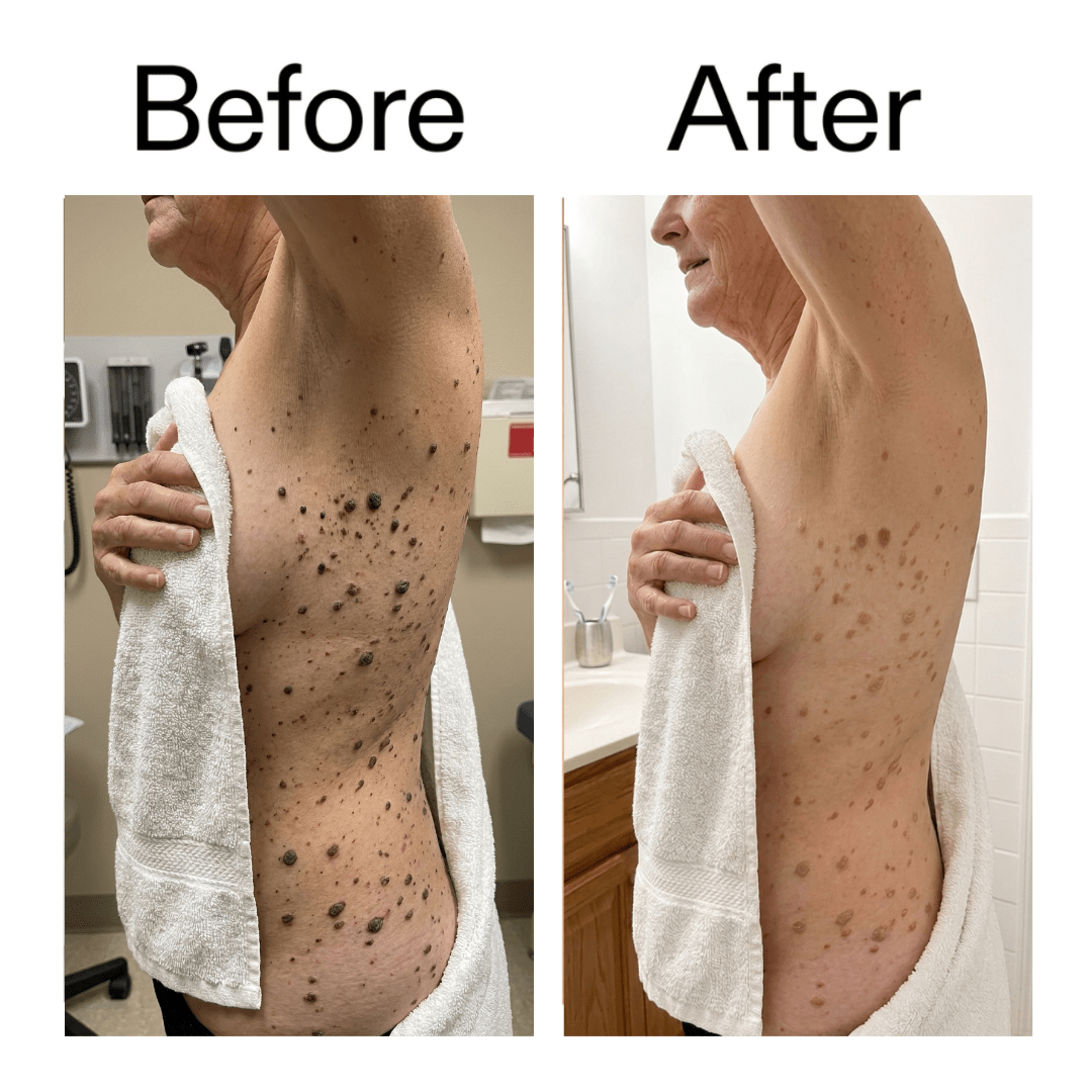 Stick Lissant Glycolique