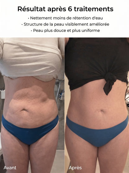Lyvona – une peau lisse en 14 jours