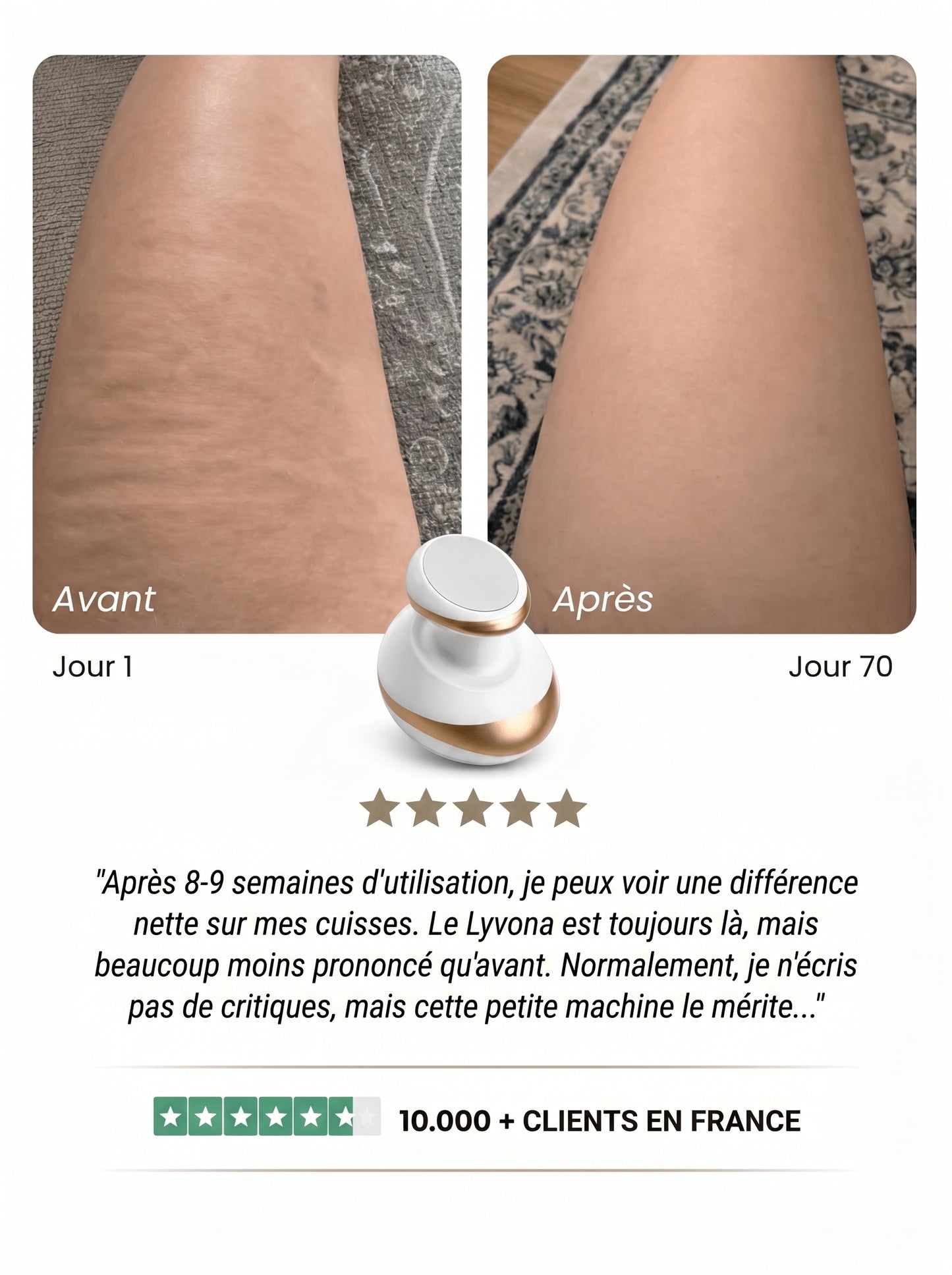 Lyvona – une peau lisse en 14 jours